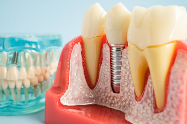 Best Tooth Extraction  in Greenbriar, FL